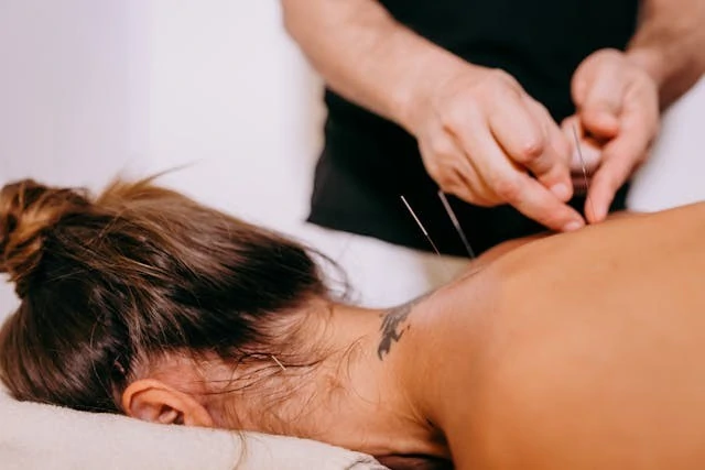 Acupuncture for Stress & Anxiety